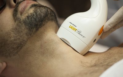 Depilação-a-laser-Curitiba-sessões-Light-Sheer-Duet